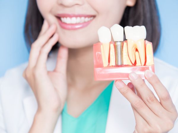 dental implants Dallas